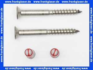 Keuco Befefestigungs-Set 2 Plan Care 34991, 2xSenkschraube 10x80 V2A 2xDübel UX12 34991000100
