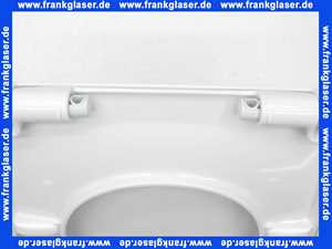 536434 VIGOUR WC-Sitz derby rund m. Edelstahlscharnier abnehmbar mit Absenkautomatik weiss